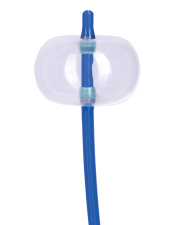 jayaphoto_2022_Endoscopy_ERCP_Stone_Retri_Balloon_Detail